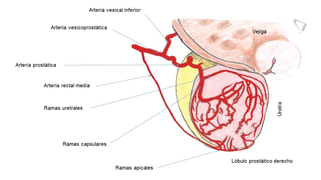 Figura 4. Esquema de la vascularización arterial prostática según los estudios tradicionales.