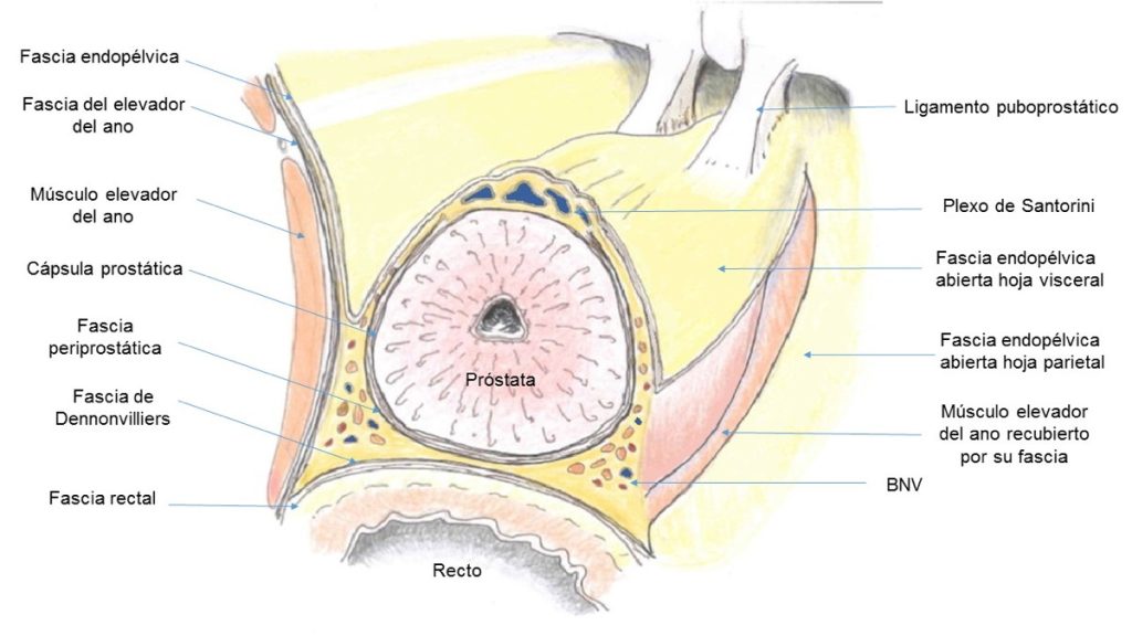 Figura 6. Fascias prostáticas. En el lado derecho la fascia endopélvica se encuentra abierta.